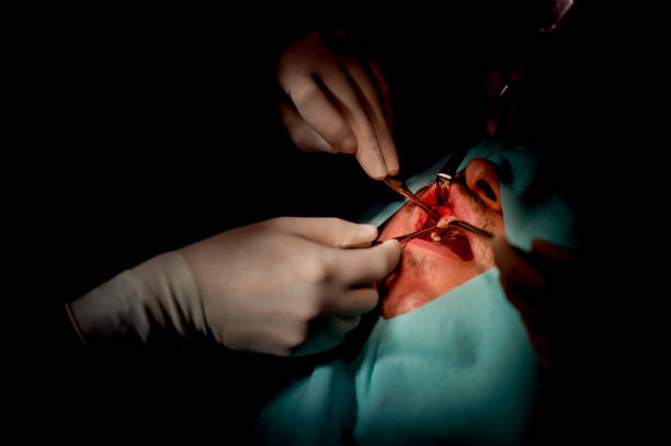 Overbite Jaw Surgery and Vertical Labret Piercing: Understanding the Intersection of Aesthetic and Functional Recovery